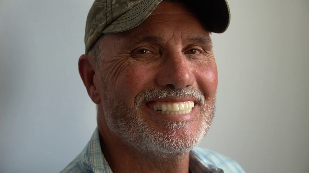 How to Get Dental Implants Covered by Insurance
